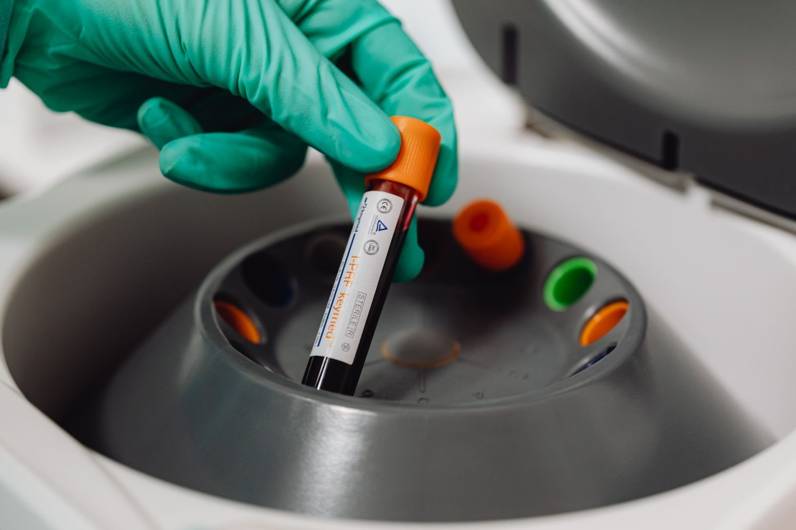 Médecin tenant un tube de prélèvement sanguin pour analyse
